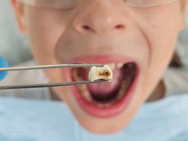 Best Dentist for Dental Trauma  in Dunlap, TN